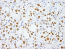 ADNP Antibody, Novus Biologicals 0.1 mL | Buy Online | Novus Biologicals | Fisher Scientific